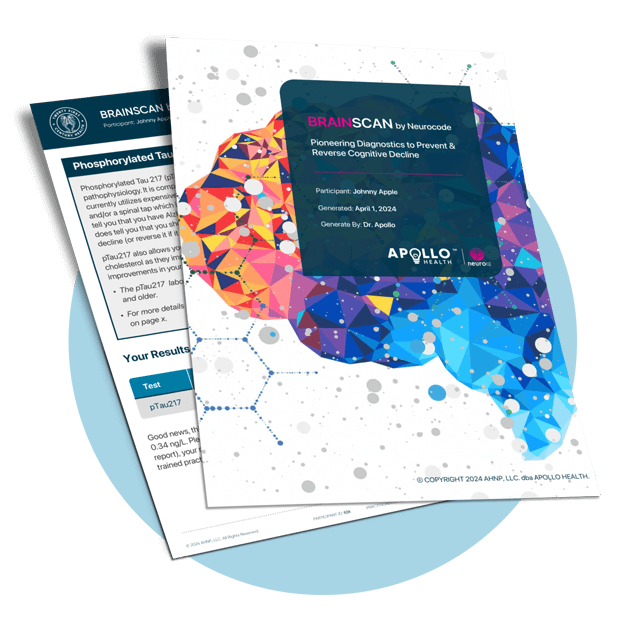 brainscan-report-example2-1x-1 - Pacific Pearl of La Jolla